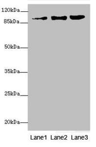 Polyclonal Rabbit anti-Human ZNF148 / ZBP-89 Antibody (IHC, WB)