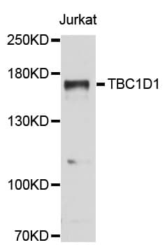 TBC1 / TBC1D1 Antibody