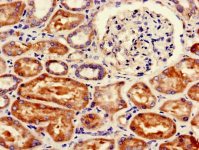 Polyclonal Rabbit anti-Human FANCC Antibody