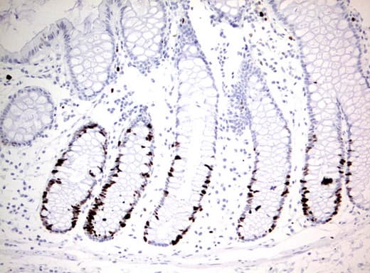MKI67 / Ki67 Antibody (aa1160-1493, clone UMAB107, Carrier-free)