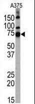 Polyclonal Rabbit anti-Human HDAC10 Antibody (aa16-46, WB)