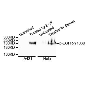 EGFR Antibody (phospho-Tyr1068)