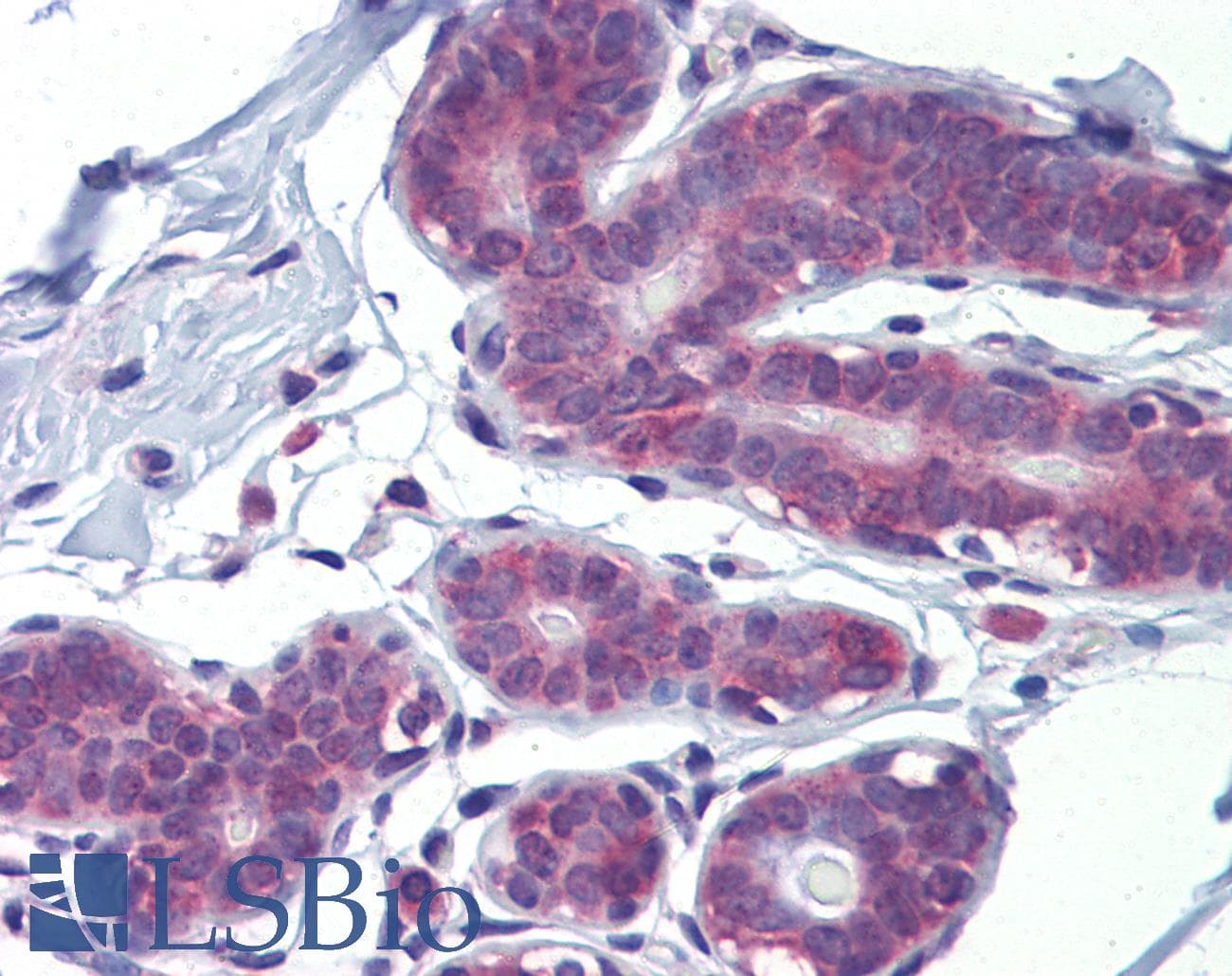 LDOC1 Antibody (N-Terminus)