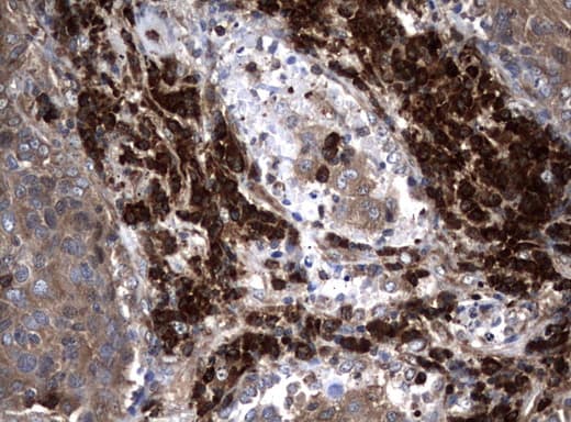 NME1 / NM23 Antibody (clone UMAB93, Carrier-free)