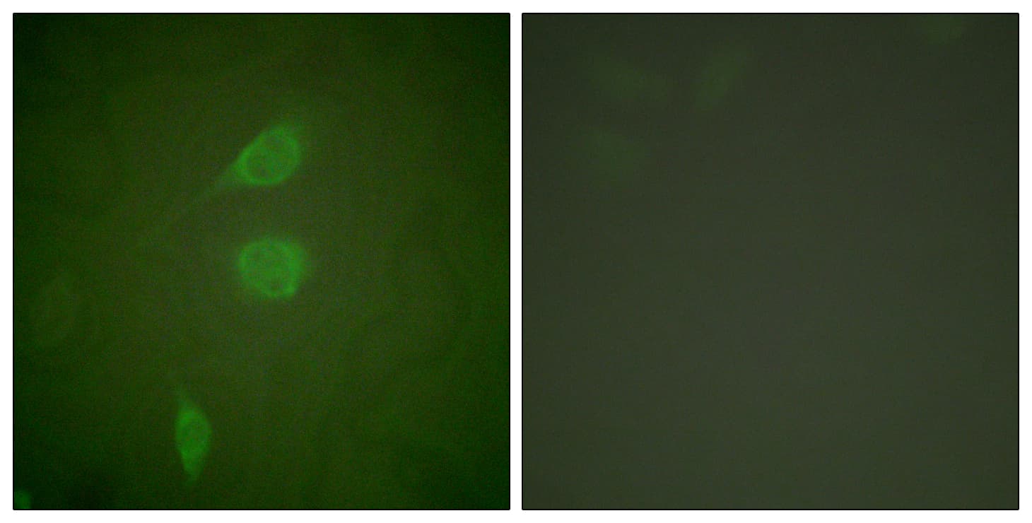 HDAC5 Antibody (aa1073-1122)
