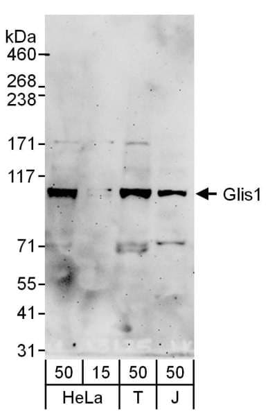 Polyclonal Rabbit anti-Human GLIS1 Antibody (aa570-620, WB)