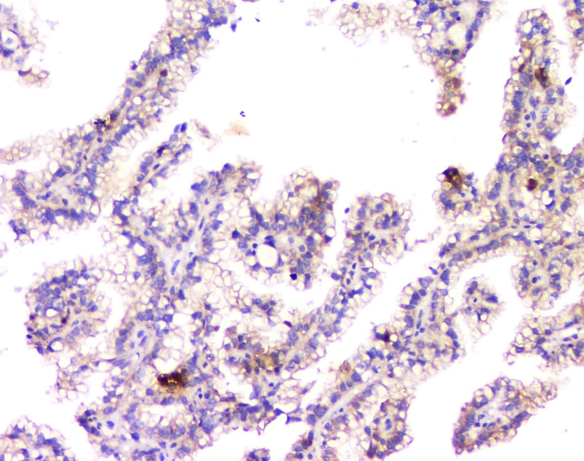 APP / Beta Amyloid Precursor Antibody (aa672-713)