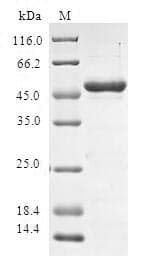 Human SPAG16 Protein (Recombinant GST, N-terminus)