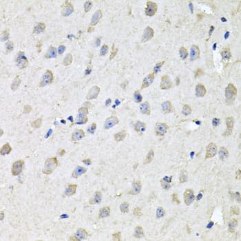 Polyclonal Rabbit anti-Human CHCHD3 Antibody (IHC, WB)