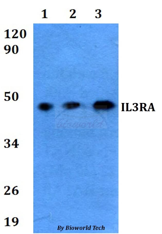 Polyclonal Rabbit anti-Human IL3RA / CD123 Antibody (WB)