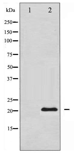 BIRC5 / Survivin Antibody