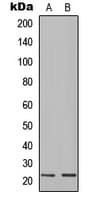 Polyclonal Rabbit anti-Human IGLL1 / CD179b Antibody (N-Terminus, WB)