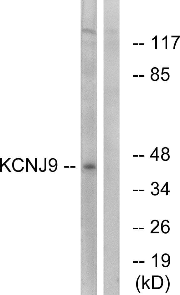Polyclonal Rabbit anti-Human KCNJ9 / Kir3.3 / GIRK3 Antibody (WB)