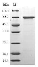 Human HDAC11 Protein (Recombinant GST, N-terminus)