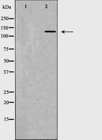 ITGAL / CD11a Antibody