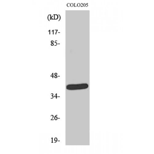 Polyclonal Rabbit anti-Human NEGR1 / Neurotractin Antibody (150-230 aa, Internal, WB)