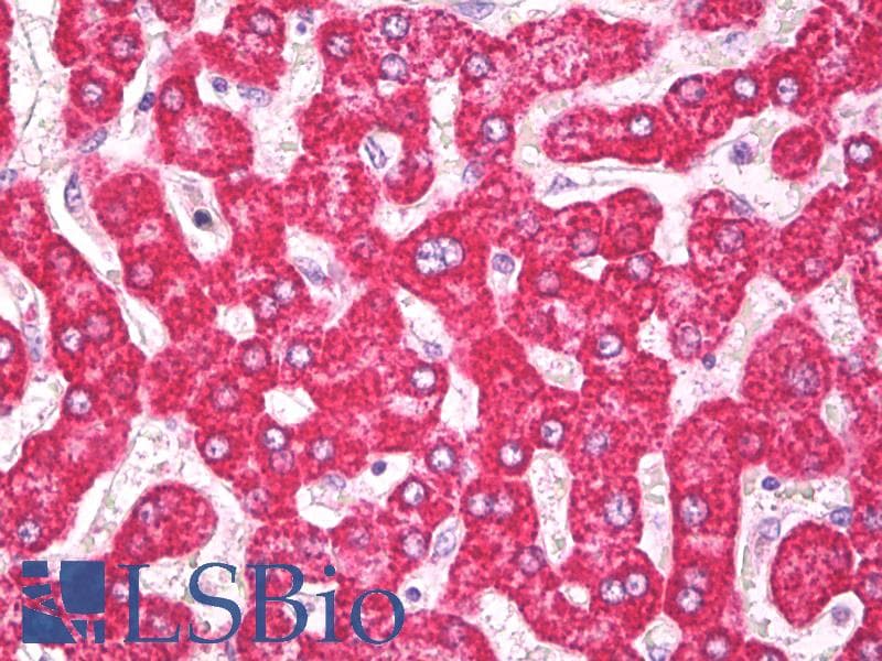 IHC-plus™ ACOT13 / THEM2 Antibody (aa100-150)