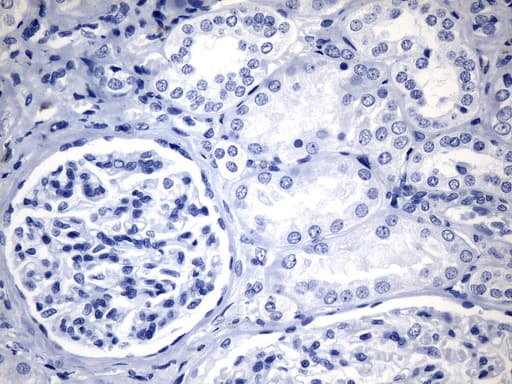CTLA4 / CD152 Antibody (clone UMAB249)