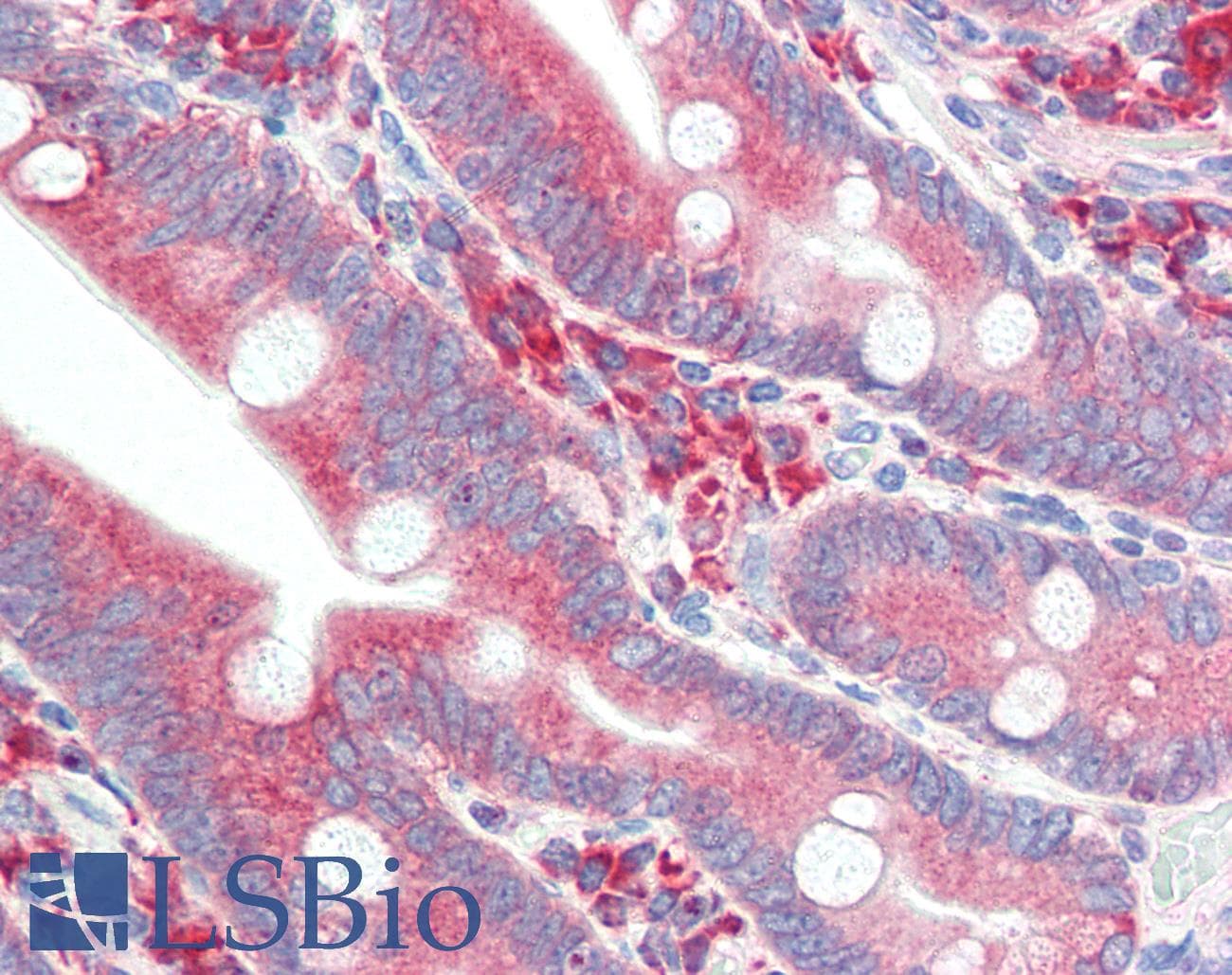 IHC-plus™ Polyclonal Rabbit anti-Rat HYOU1 / ORP150 Antibody (C-Terminus, IHC, WB)