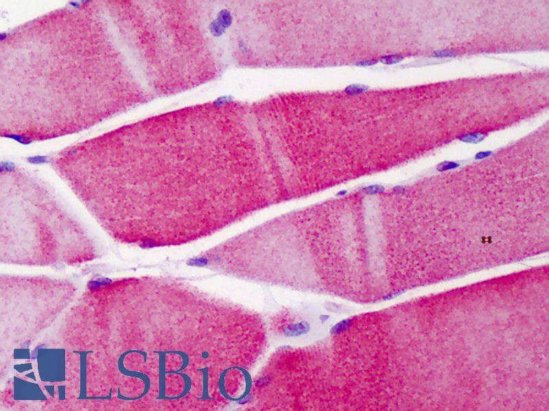 IHC-plus™ ACTN3 Antibody (aa1-50)