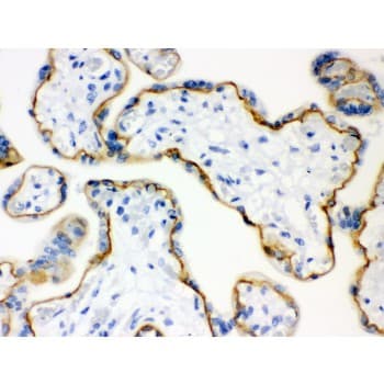 CDH1 / E Cadherin Antibody (aa286-703)