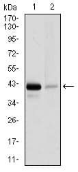 PathPlus™ PAX5 Antibody (clone 1A7)