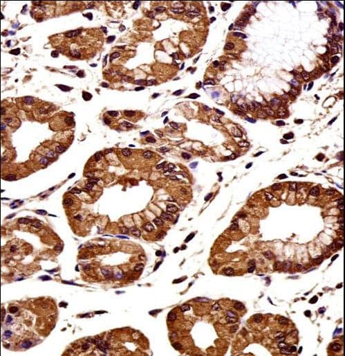 CTNNB1 / Beta Catenin Antibody (aa692-721)