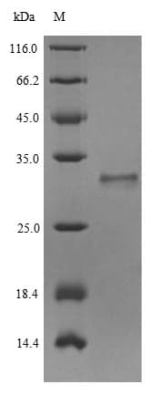 Human MYO7A / Myosin-VIIa Protein (Recombinant 6His-SUMO, N-terminus)