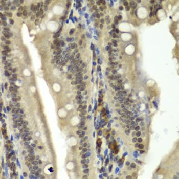 Polyclonal Rabbit anti-Human RBBP5 Antibody (IHC, IF, WB)