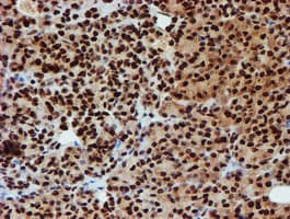 Monoclonal Mouse anti-Human PADI4 / PAD4 Antibody (clone OTI4H5, IHC, IF, WB)