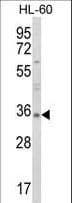 TNFSF11 / RANKL / TRANCE Antibody (aa1-30)