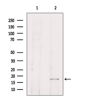 Polyclonal Rabbit anti-Human TP53I11 / PIG11 Antibody (IHC, IF, WB)