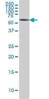 IHC-plus™ CBFA1 / RUNX2 Antibody (clone 1D8)