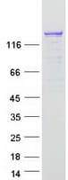 Human CIZ1 Protein (Recombinant Myc-DDK (Flag))