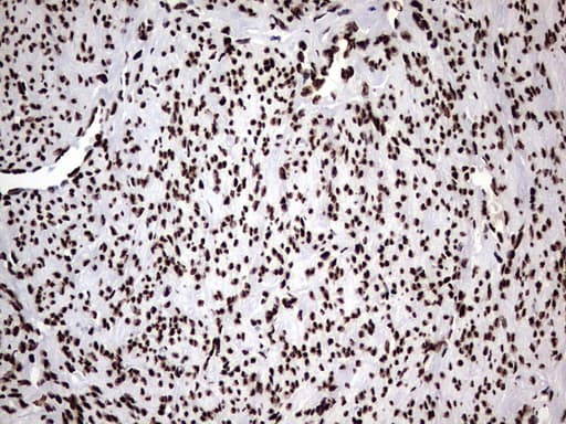 HNRPM / HNRNPM Antibody (aa1-261, clone OTI4C9)