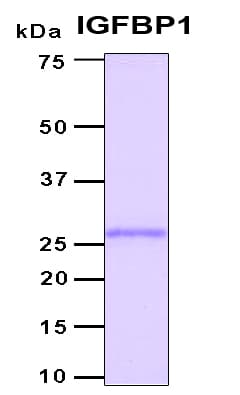 Human IGFBP1 Protein (Recombinant 6His, N-terminus)
