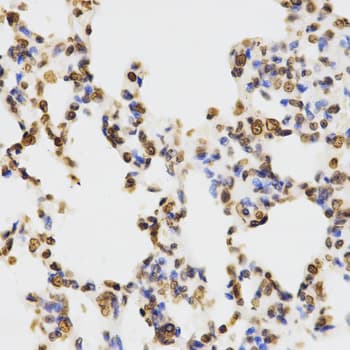 Histone H3 Antibody (Di-Methyl-Lys9)