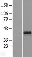 OPTC / Opticin Protein (Over-Expression Lysate Myc-DDK (Flag))