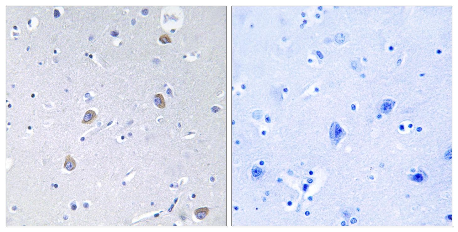 RPS6KB1 / P70S6K / S6K Antibody (phospho-Ser371)