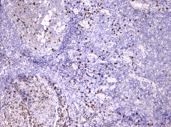 Polyclonal Rabbit anti-Human IGLL1 / CD179b Antibody (IHC, WB)
