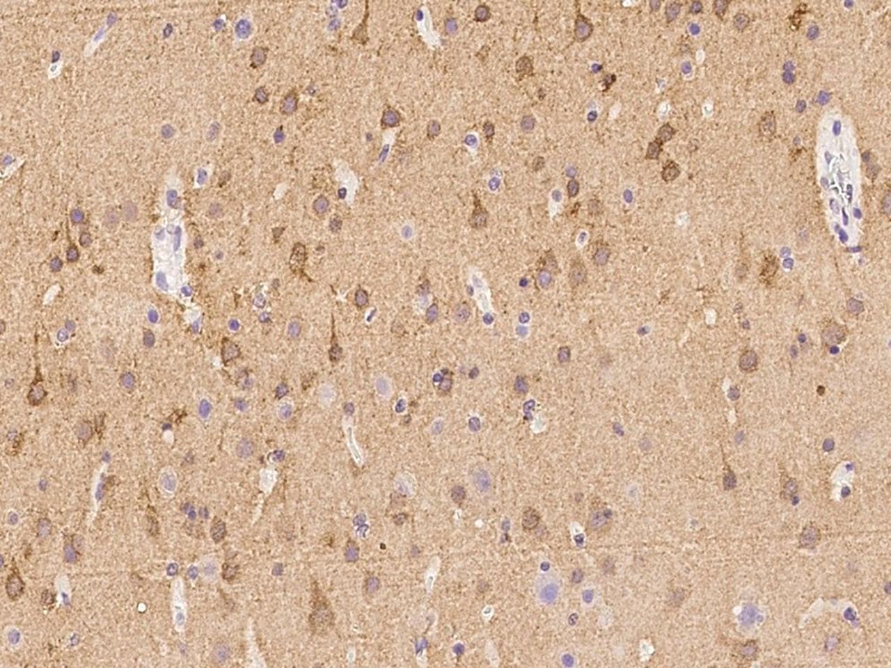 Polyclonal Rabbit anti-Human HPCA / Hippocalcin Antibody (IHC)