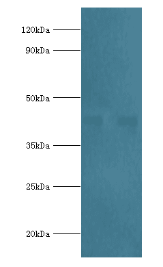 Polyclonal Rabbit anti-Human SCAD / ACADS Antibody (aa1-260, IHC, WB)
