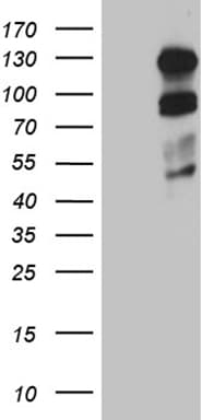 PLK4 / SAK Antibody (aa307-612, clone OTI2B6)