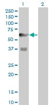 PFK2 / PFKFB3 Antibody (clone 3F3)