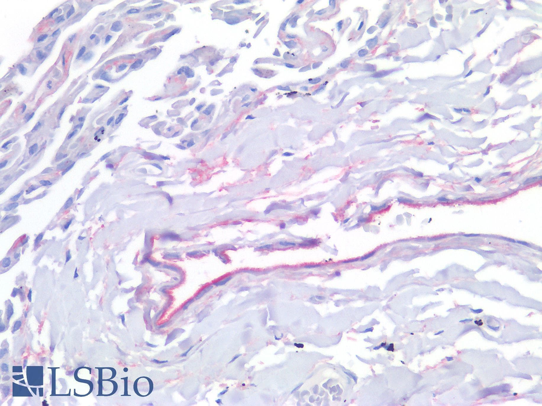 IHC-plus™ MSLN / Mesothelin Antibody