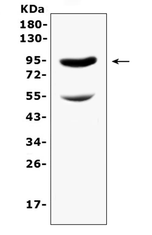 CD105 Antibody