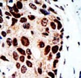 HDAC9 Antibody (aa503-533)