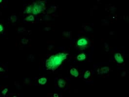 Monoclonal Mouse anti-Human PHF21B Antibody (clone OTI5D2, IHC, IF, WB)