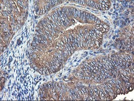 TUBAL3 Antibody (aa150-446, clone OTI2F6, Carrier-free)