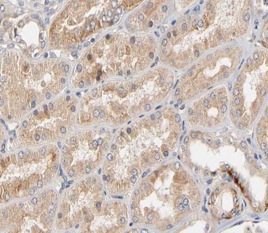 Polyclonal Rabbit anti-Human CLDN2 / Claudin 2 Antibody (IHC, IF, WB)
